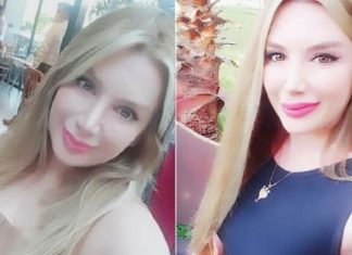 Botoks Yaptırdıktan Sonra Öldü