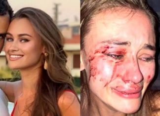 Ünlü Top Model Coronaviruse Yakalandı