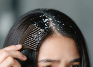 Kepeği Yok Etmenin Etkili Yolları